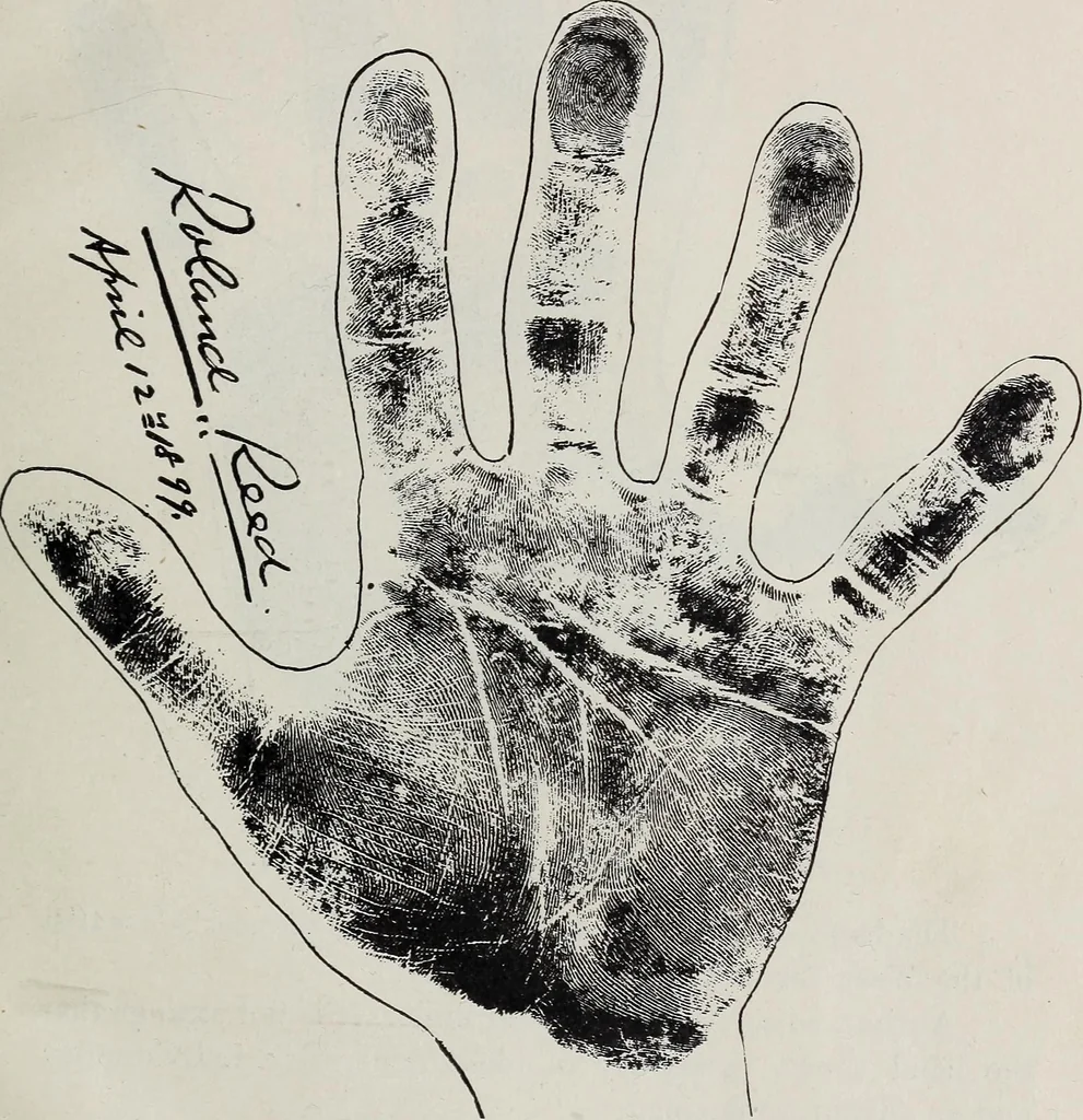 An illustration from Revelations of the hand. A scientific study of the shape and markings of the hand, as an index to character, disease, and tendencies, with explanatory illustrations, 1900, leaf 202