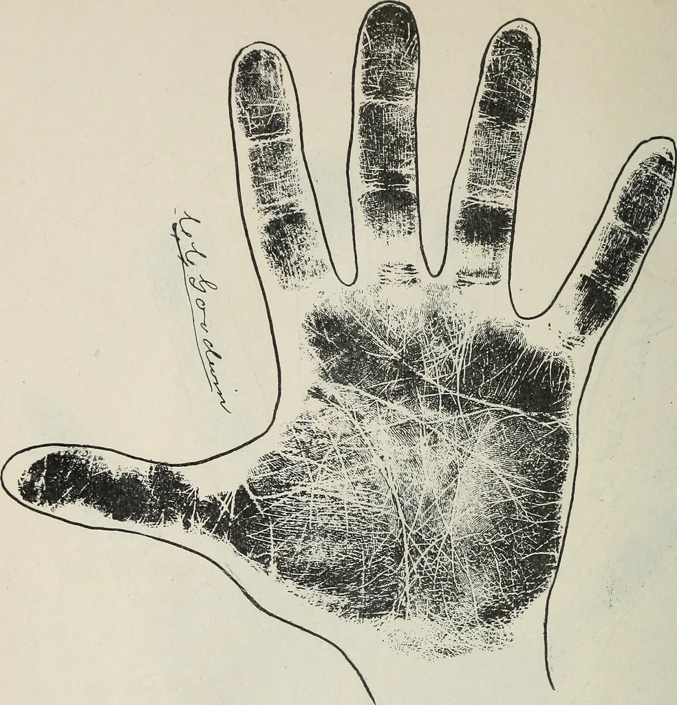 An illustration from Revelations of the hand. A scientific study of the shape and markings of the hand, as an index to character, disease, and tendencies, with explanatory illustrations, 1900, leaf 203
