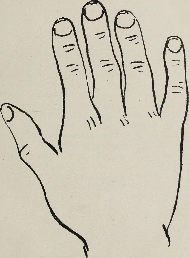 An illustration from Revelations of the hand. A scientific study of the shape and markings of the hand, as an index to character, disease, and tendencies, with explanatory illustrations, 1900, leaf 28