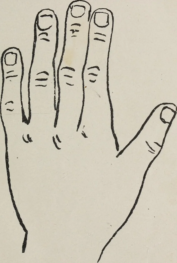 An illustration from Revelations of the hand. A scientific study of the shape and markings of the hand, as an index to character, disease, and tendencies, with explanatory illustrations, 1900, leaf 32