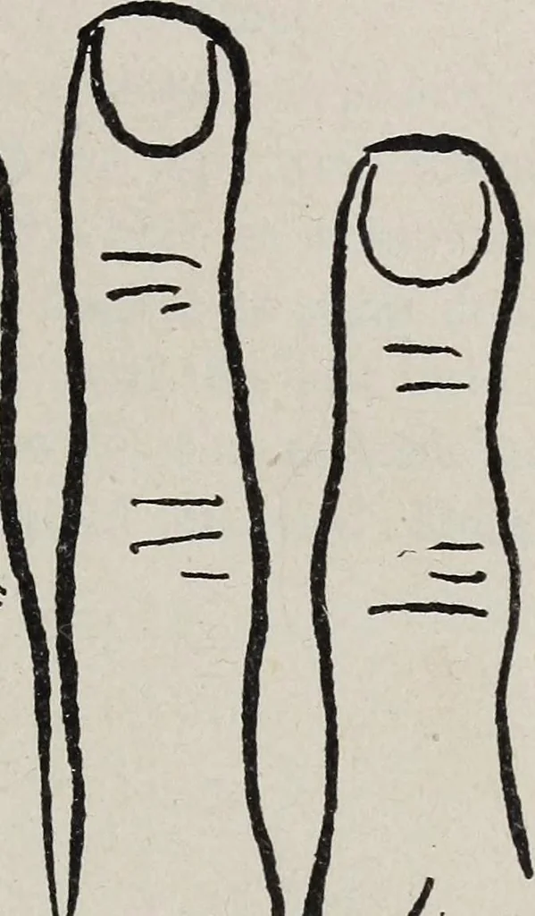An illustration from Revelations of the hand. A scientific study of the shape and markings of the hand, as an index to character, disease, and tendencies, with explanatory illustrations, 1900, leaf 36