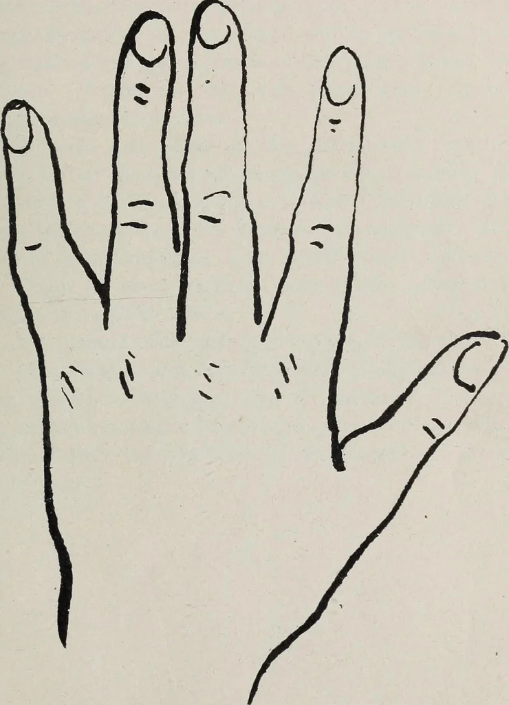 An illustration from Revelations of the hand. A scientific study of the shape and markings of the hand, as an index to character, disease, and tendencies, with explanatory illustrations, 1900, leaf 40