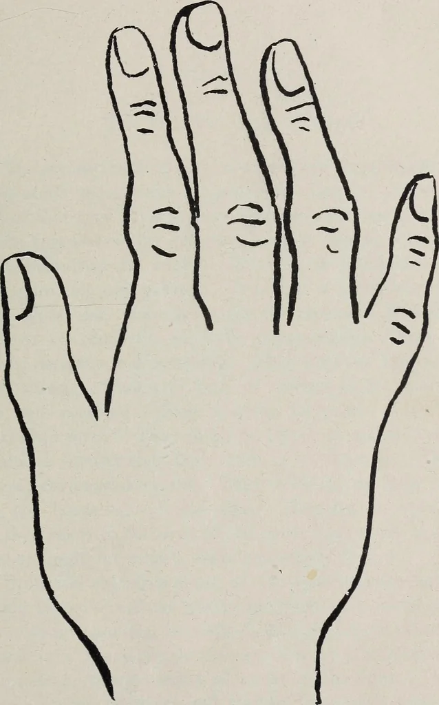 An illustration from Revelations of the hand. A scientific study of the shape and markings of the hand, as an index to character, disease, and tendencies, with explanatory illustrations, 1900, leaf 44