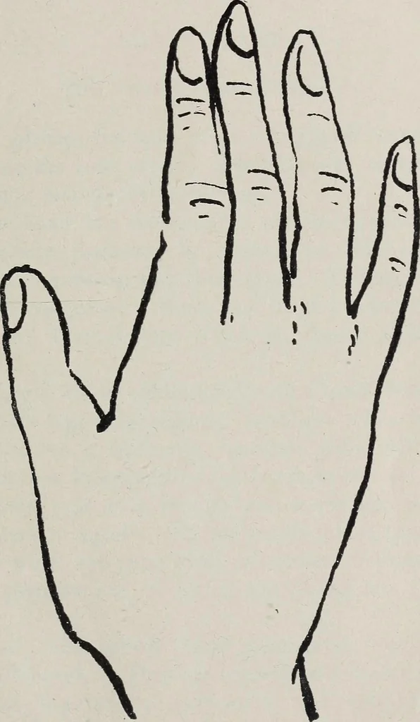 An illustration from Revelations of the hand. A scientific study of the shape and markings of the hand, as an index to character, disease, and tendencies, with explanatory illustrations, 1900, leaf 48