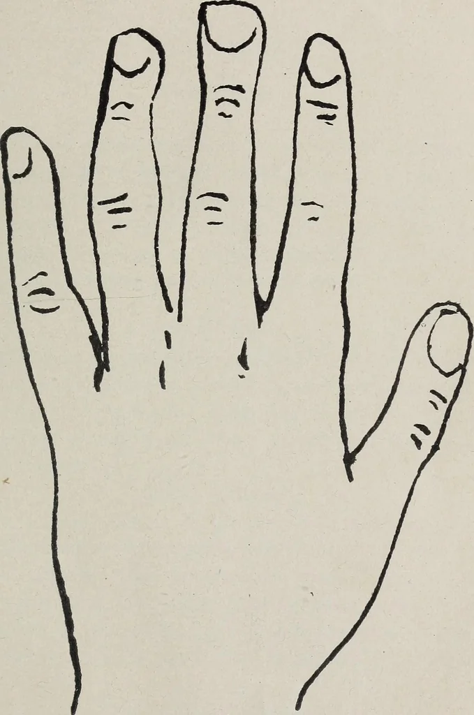 An illustration from Revelations of the hand. A scientific study of the shape and markings of the hand, as an index to character, disease, and tendencies, with explanatory illustrations, 1900, leaf 52