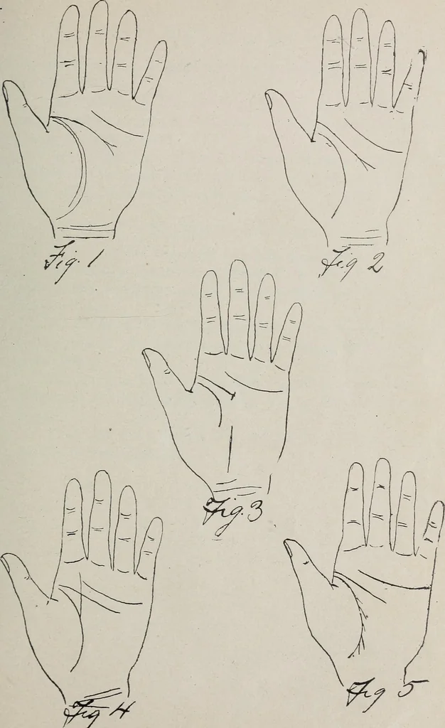 An illustration from Revelations of the hand. A scientific study of the shape and markings of the hand, as an index to character, disease, and tendencies, with explanatory illustrations, 1900, leaf 90