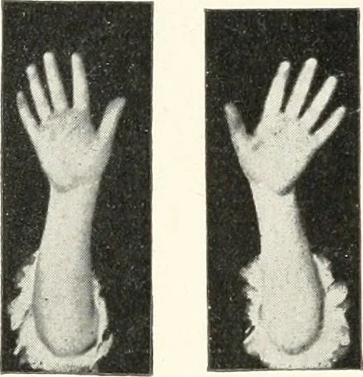 An illustration from Rhymes for little hands, 1906, leaf 31