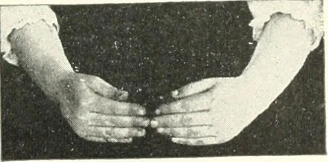 An illustration from Rhymes for little hands, 1906, leaf 54