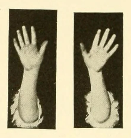 An illustration from Rhymes for little hands, 1906, leaf 34
