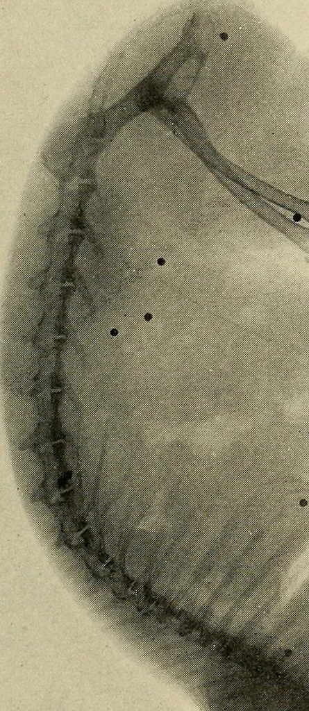 An illustration from Röntgenphotographie : Anleitung zu leicht auszuführenden Arbeiten mit statischer und galvanischer Elektrizität unter besonderer Berücksichtigung der Influenz-Elektrisiermaschine, 1908, leaf 102