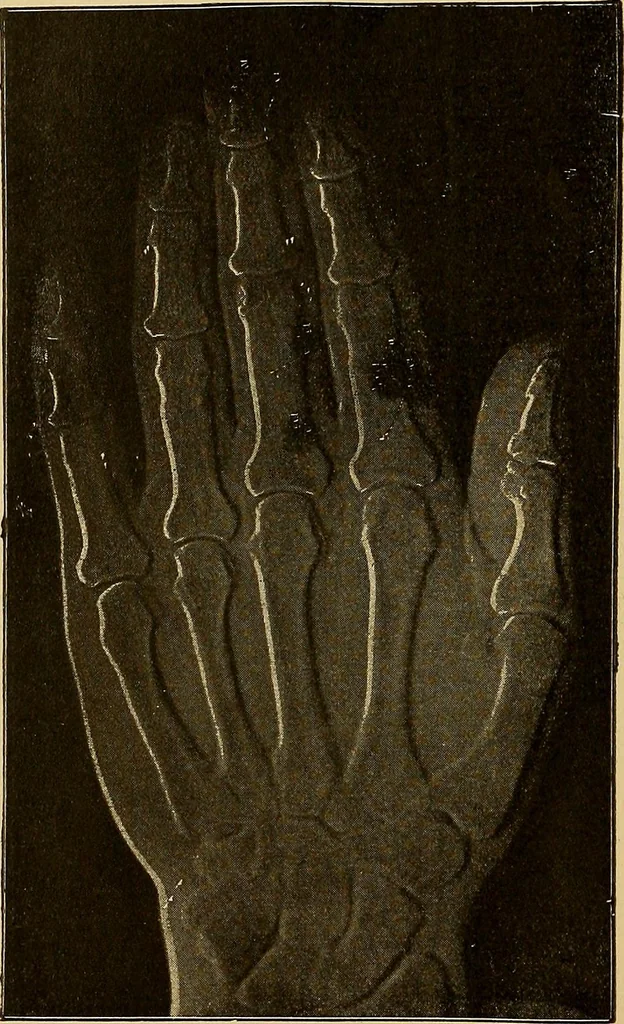 An illustration from Röntgenphotographie : Anleitung zu leicht auszuführenden Arbeiten mit statischer und galvanischer Elektrizität unter besonderer Berücksichtigung der Influenz-Elektrisiermaschine, 1908, leaf 73