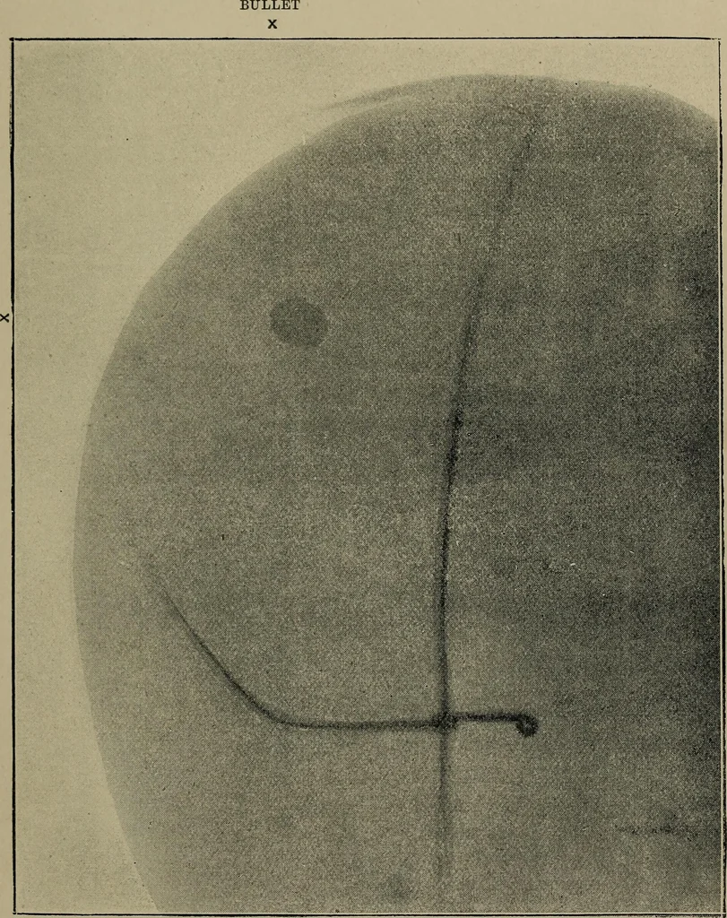 An illustration from The Röntgen rays in medical work, 1899, leaf 114