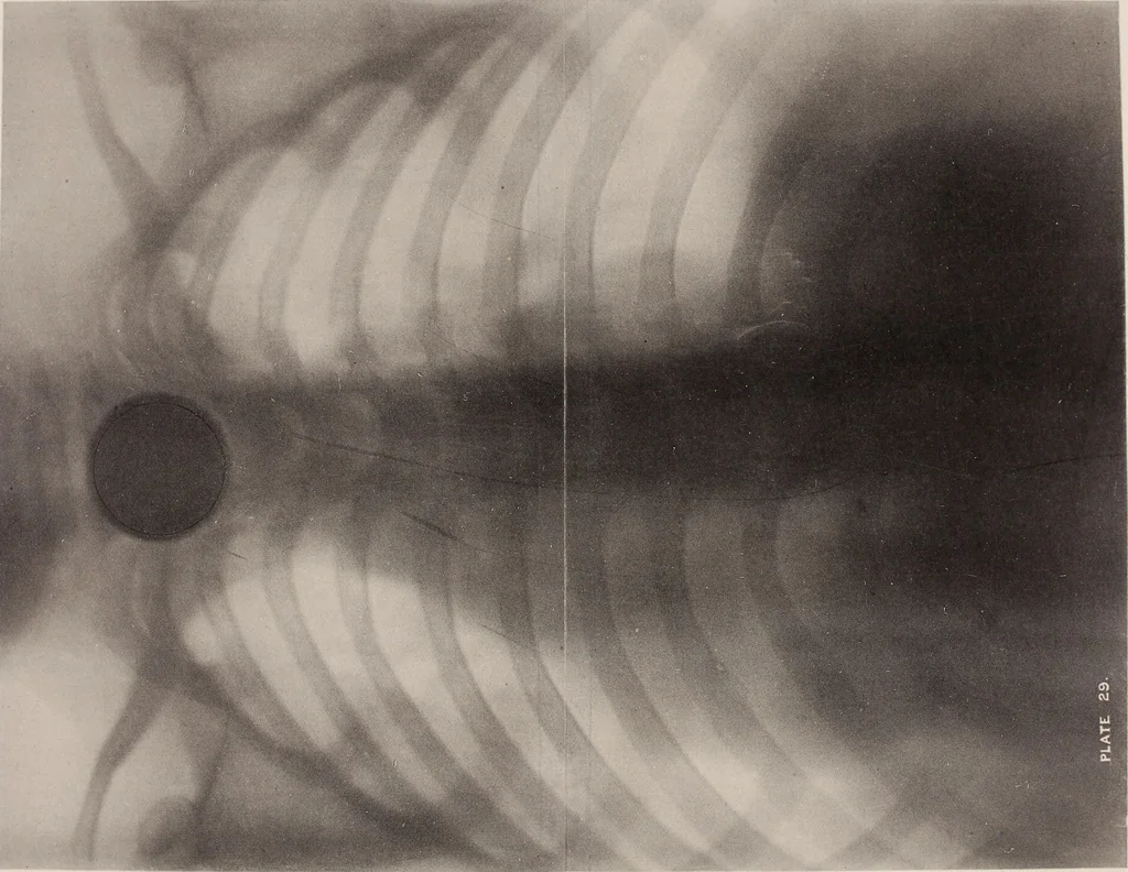 An illustration from The Röntgen rays in medical work, 1899, leaf 127
