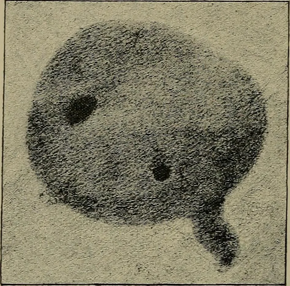 An illustration from The Röntgen rays in medical work, 1899, leaf 135