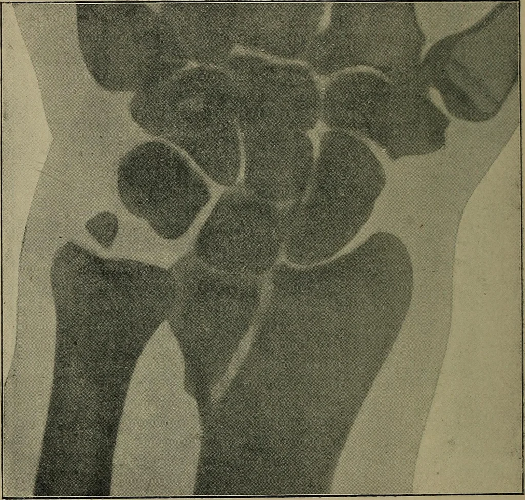 An illustration from The Röntgen rays in medical work, 1899, leaf 165