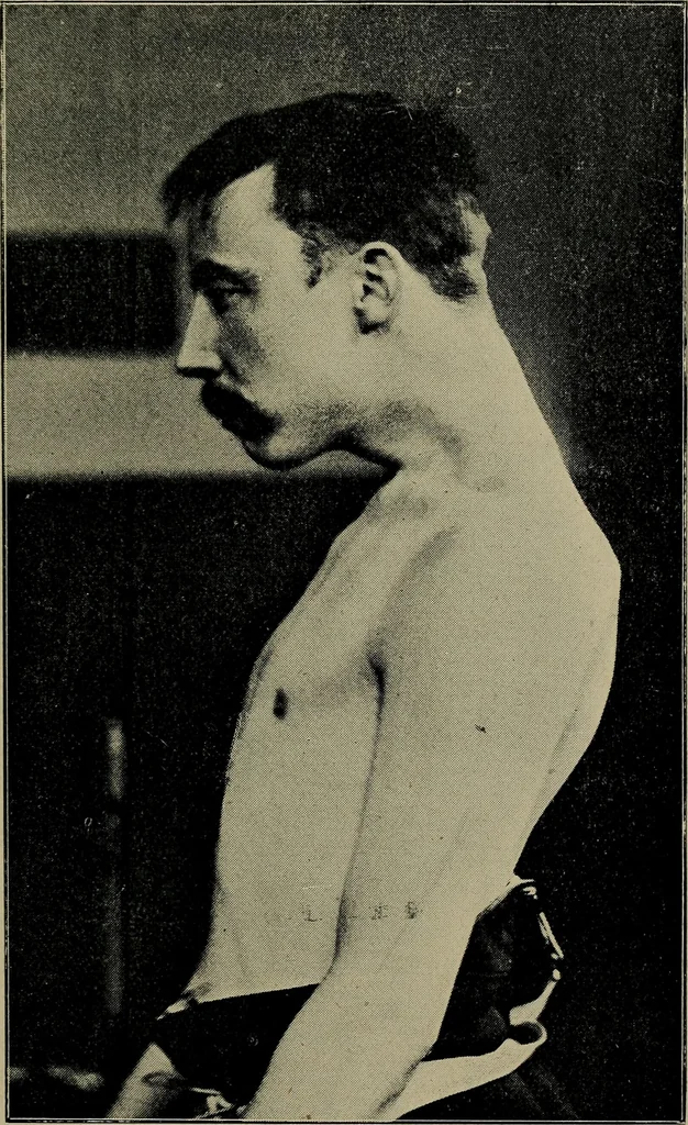 An illustration from The Röntgen rays in medical work, 1899, leaf 186