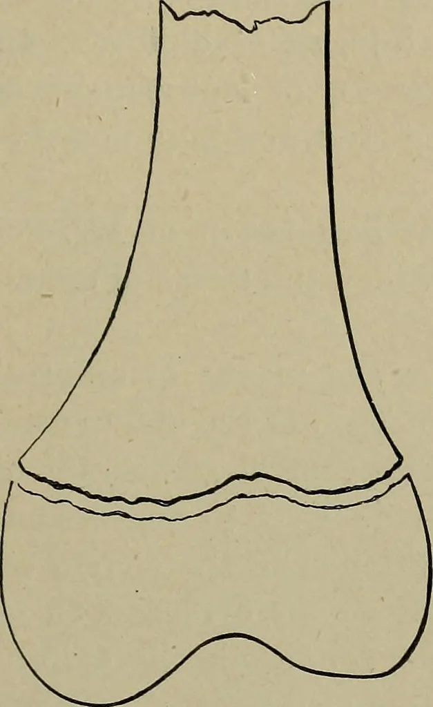 An illustration from The Röntgen rays in medical work, 1899, leaf 200