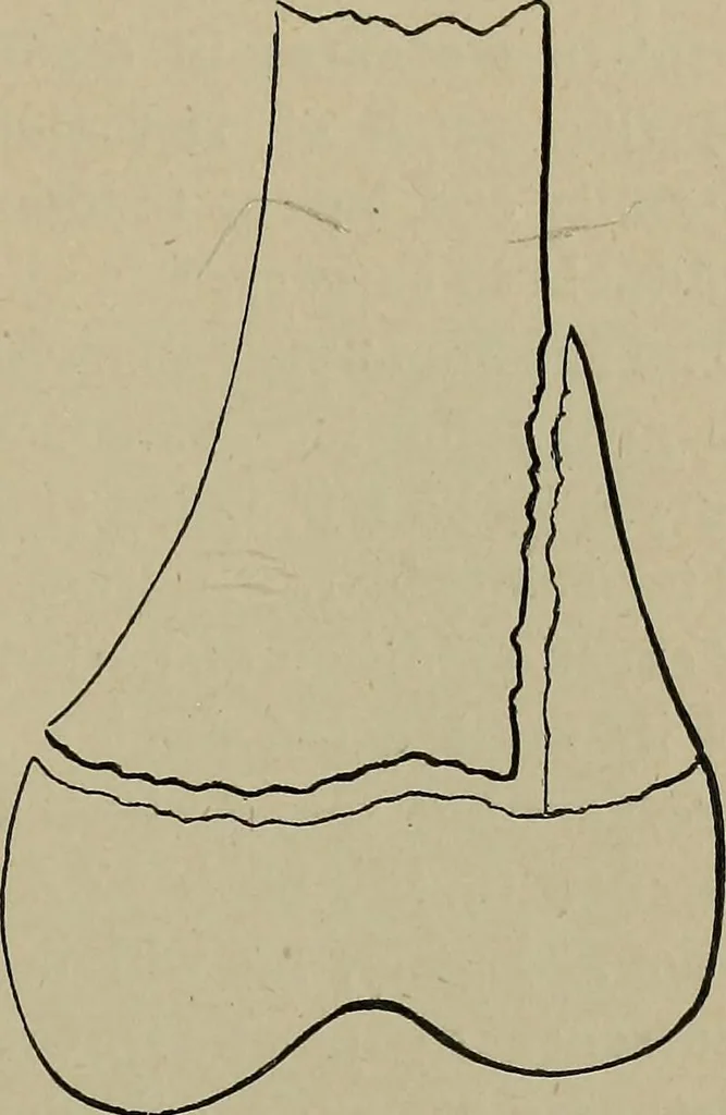 An illustration from The Röntgen rays in medical work, 1899, leaf 200