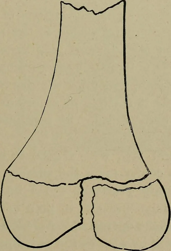 An illustration from The Röntgen rays in medical work, 1899, leaf 200