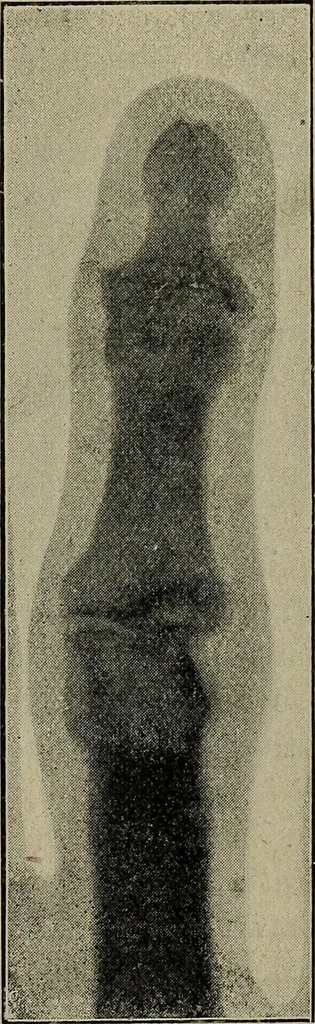 An illustration from The Röntgen rays in medical work, 1899, leaf 226
