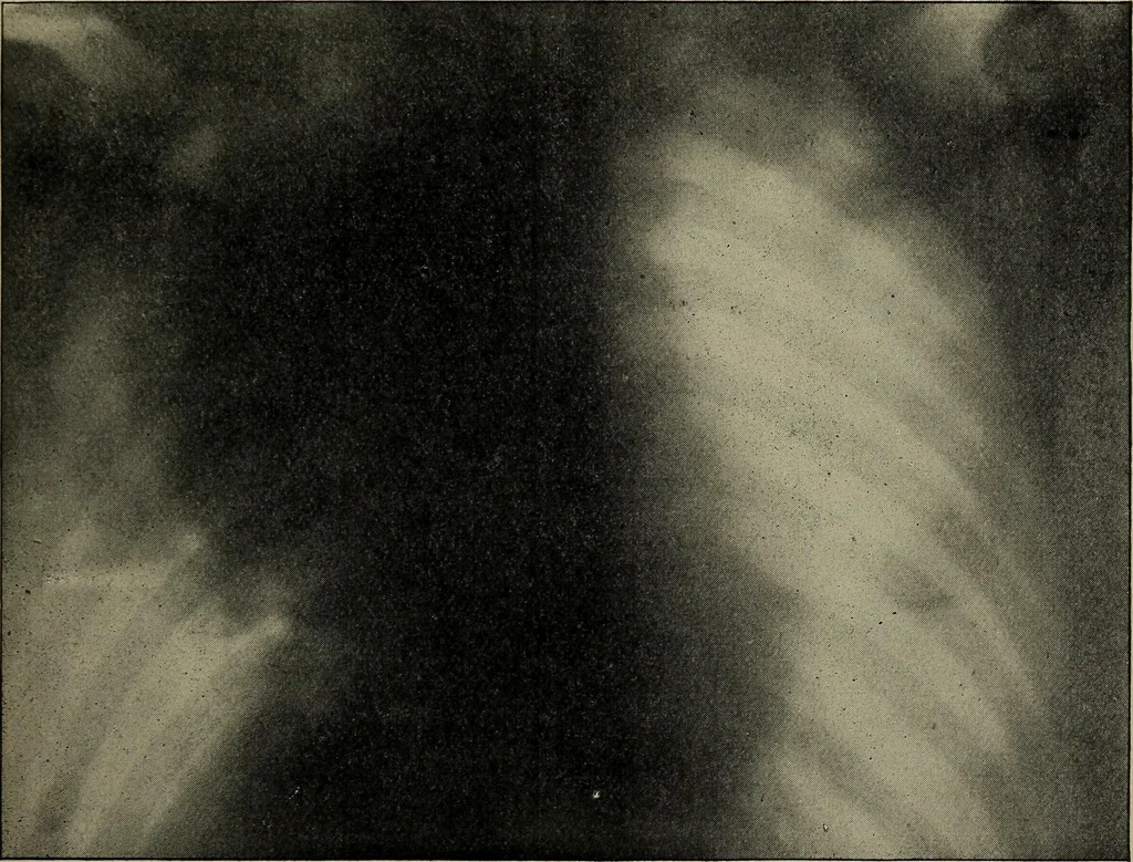 An illustration from The Röntgen rays in medical work, 1899, leaf 250