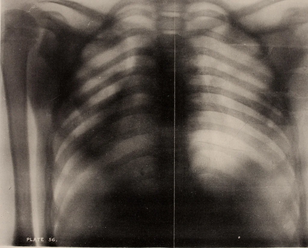 An illustration from The Röntgen rays in medical work, 1899, leaf 255