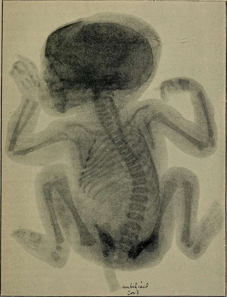 An illustration from The Röntgen rays in medical work, 1899, leaf 286