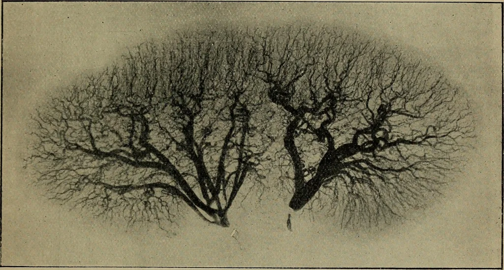 An illustration from The Röntgen rays in medical work, 1899, leaf 302