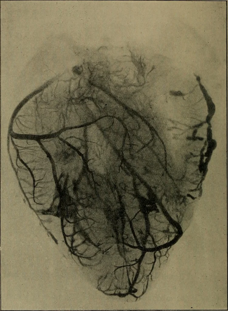 An illustration from The Röntgen rays in medical work, 1899, leaf 303