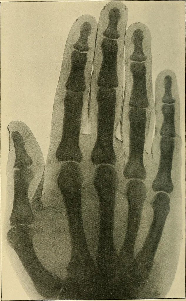 An illustration from The Röntgen rays in medical work, 1907, leaf 143