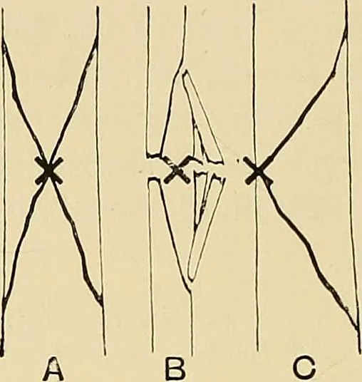 An illustration from The Röntgen rays in medical work, 1907, leaf 155