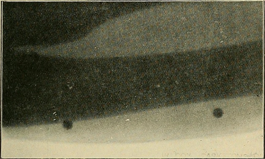An illustration from The Röntgen rays in medical work, 1907, leaf 158