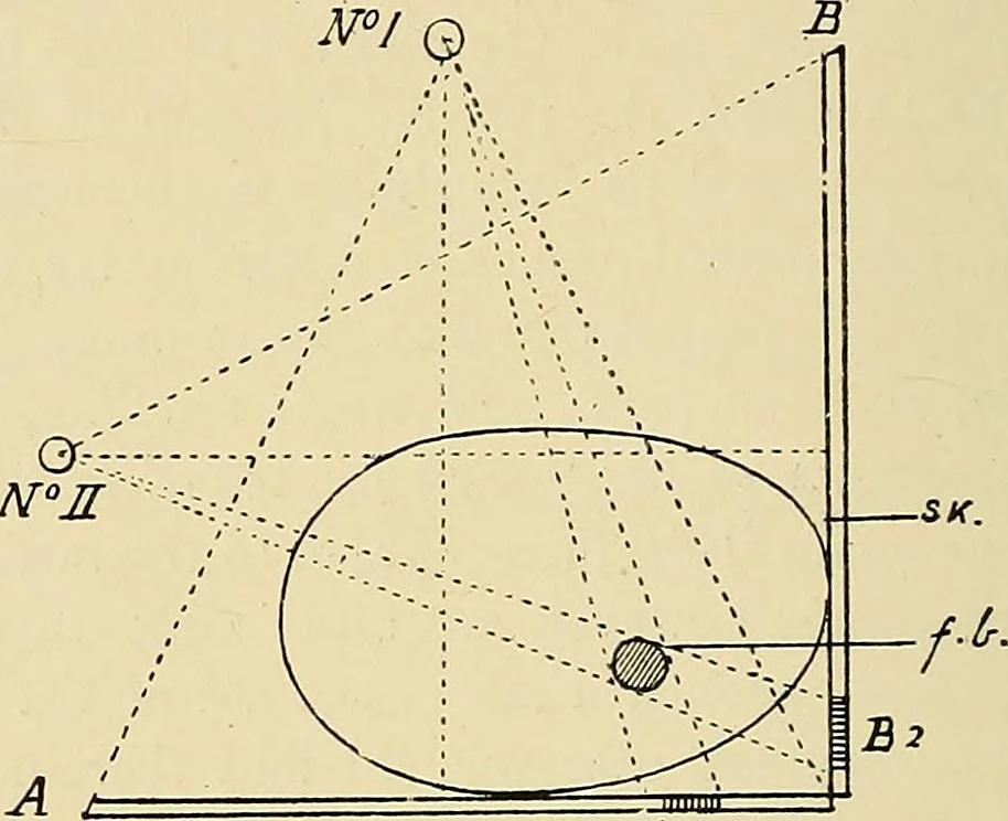 An illustration from The Röntgen rays in medical work, 1907, leaf 163