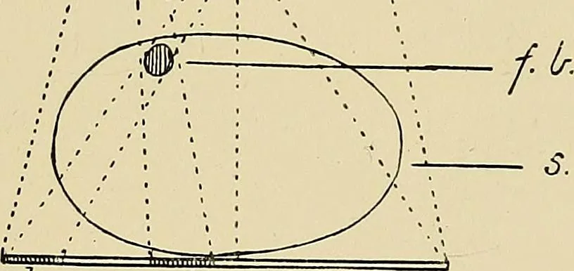 An illustration from The Röntgen rays in medical work, 1907, leaf 164