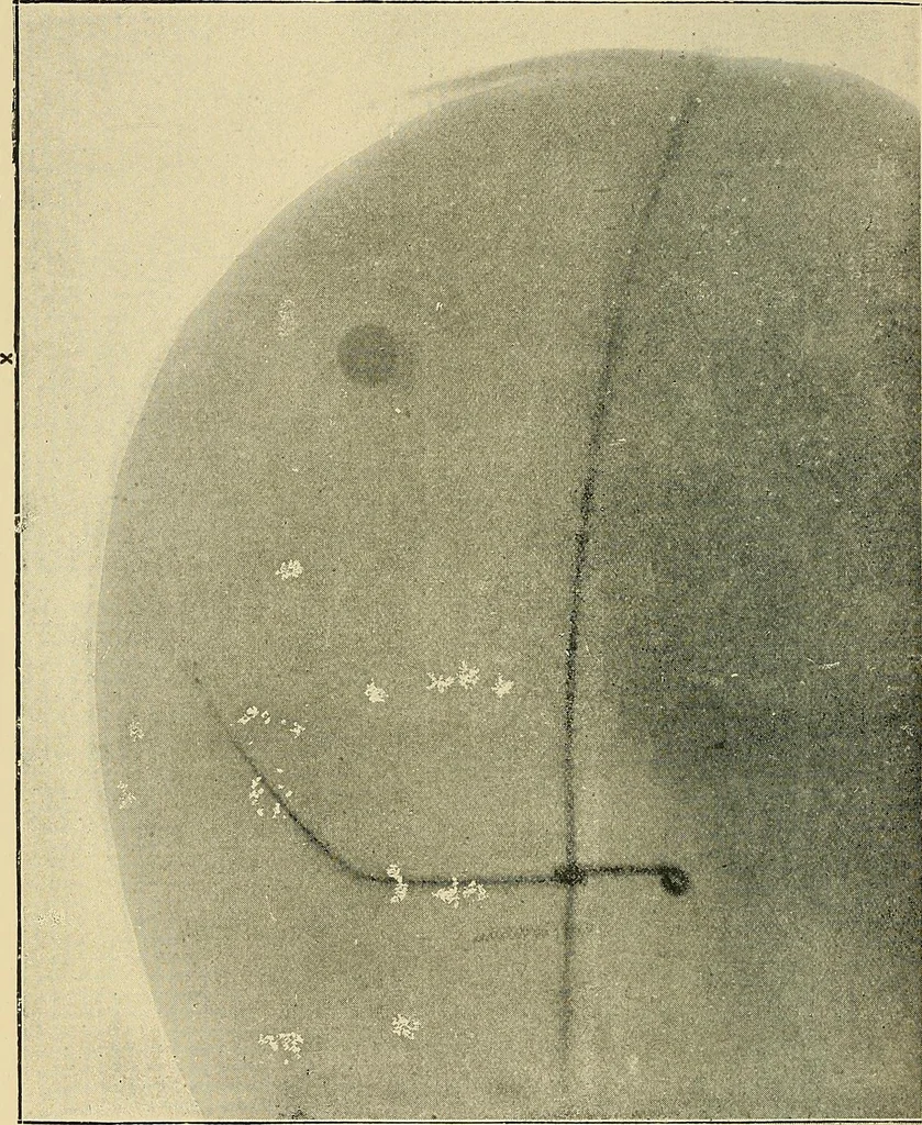 An illustration from The Röntgen rays in medical work, 1907, leaf 167