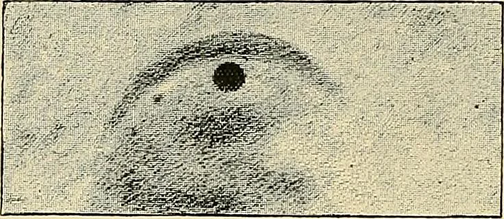 An illustration from The Röntgen rays in medical work, 1907, leaf 187
