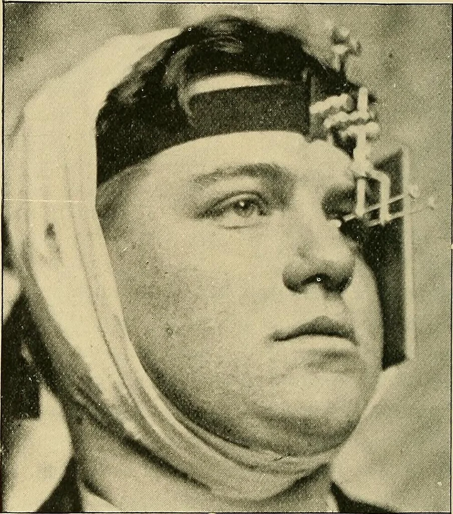 An illustration from The Röntgen rays in medical work, 1907, leaf 189