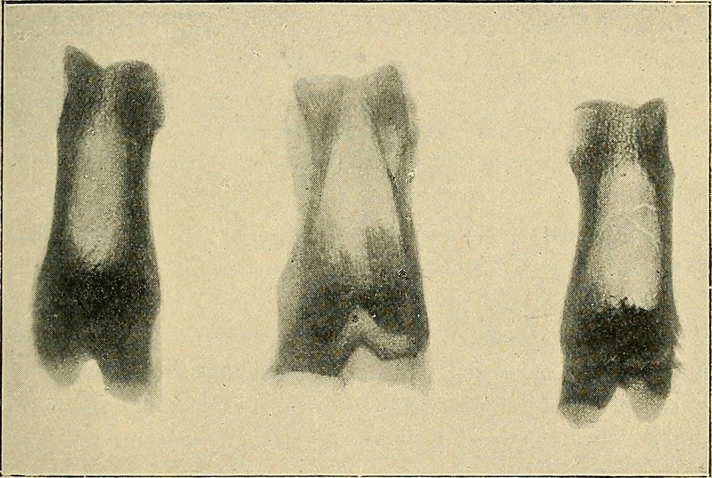 An illustration from The Röntgen rays in medical work, 1907, leaf 202