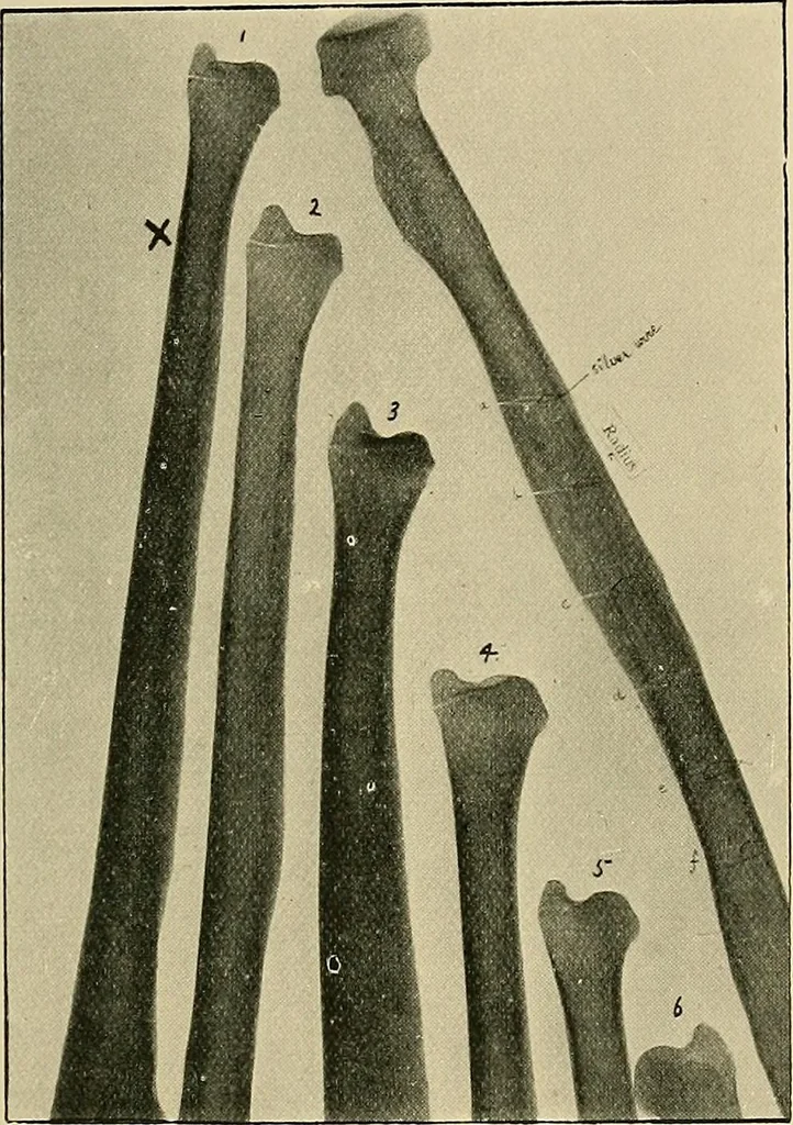 An illustration from The Röntgen rays in medical work, 1907, leaf 210