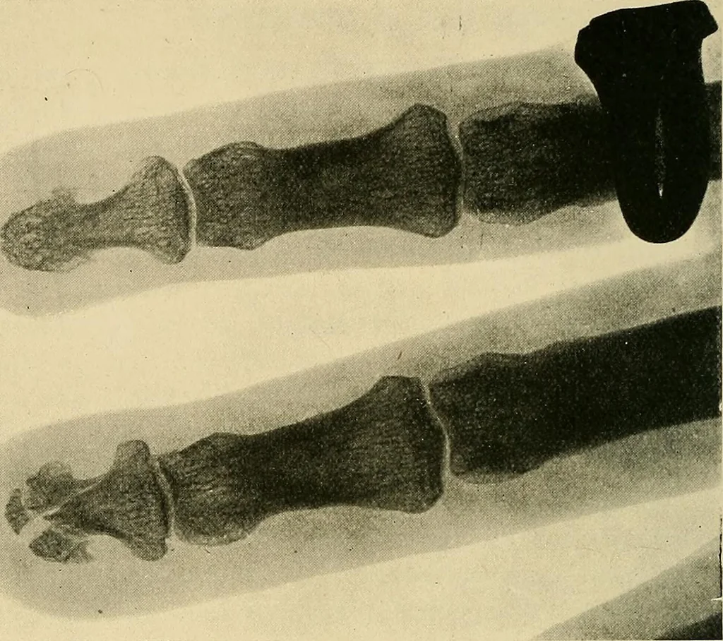 An illustration from The Röntgen rays in medical work, 1907, leaf 233