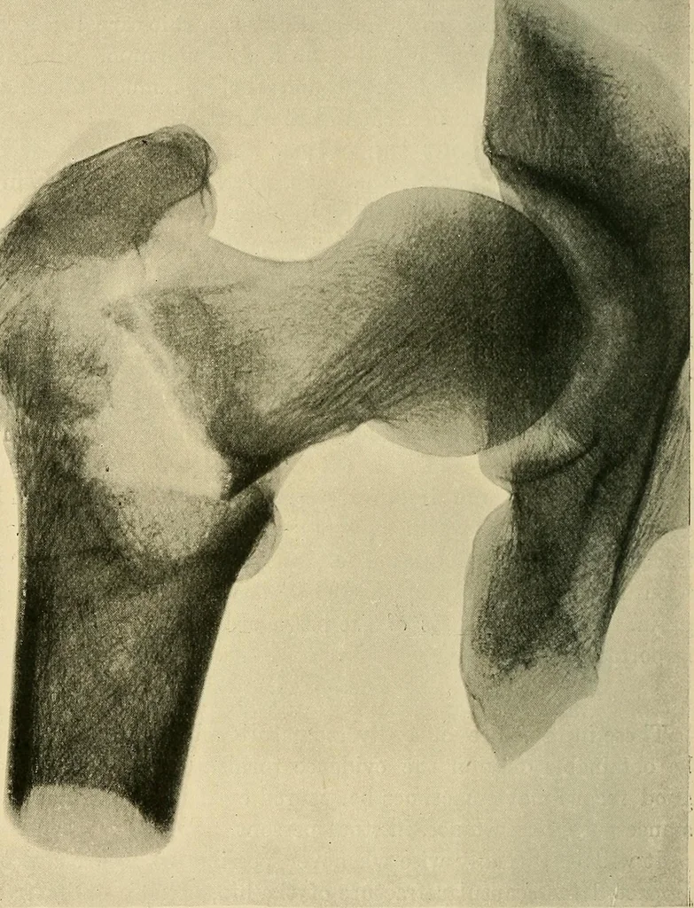 An illustration from The Röntgen rays in medical work, 1907, leaf 235