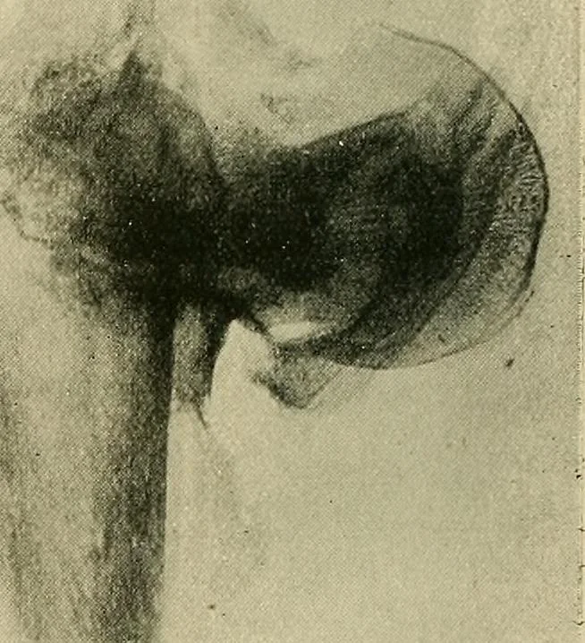 An illustration from The Röntgen rays in medical work, 1907, leaf 237