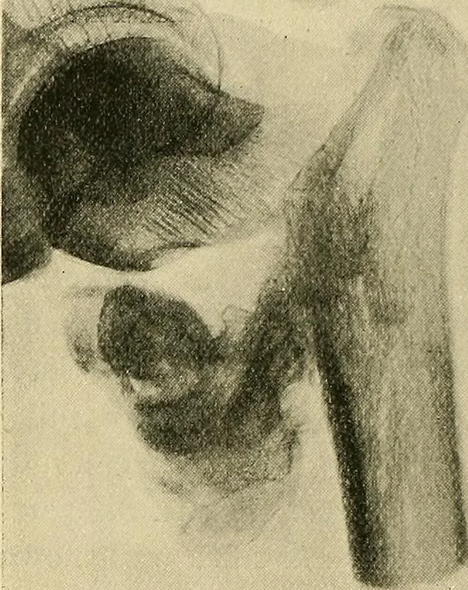 An illustration from The Röntgen rays in medical work, 1907, leaf 237