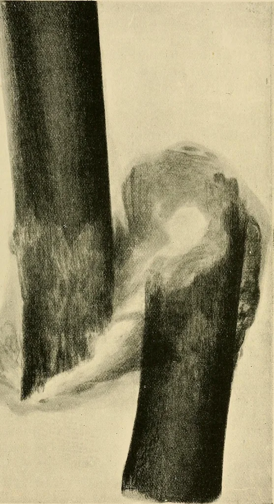 An illustration from The Röntgen rays in medical work, 1907, leaf 238