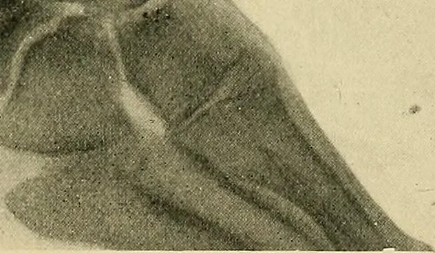 An illustration from The Röntgen rays in medical work, 1907, leaf 246
