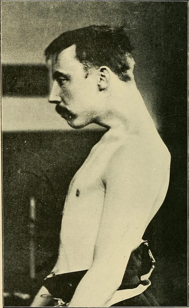 An illustration from The Röntgen rays in medical work, 1907, leaf 247