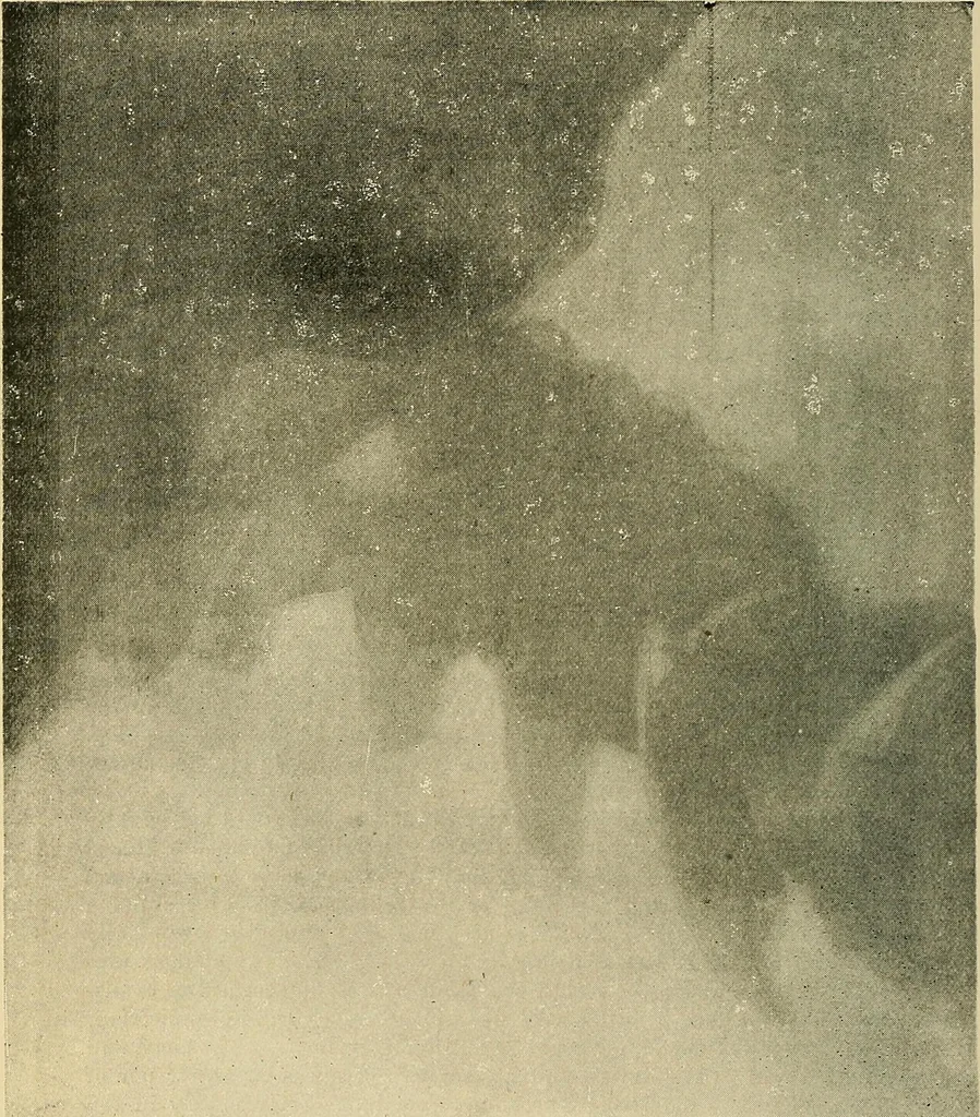 An illustration from The Röntgen rays in medical work, 1907, leaf 249