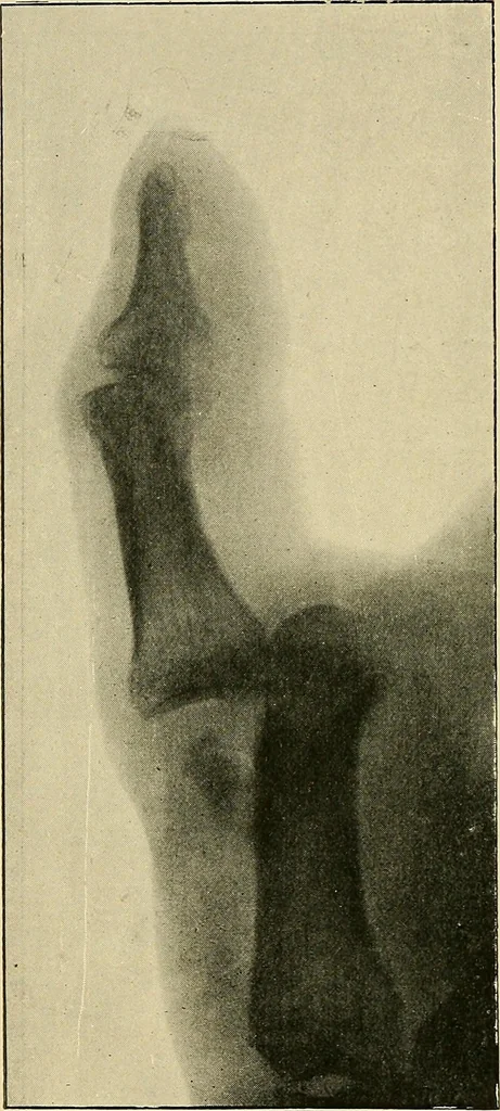 An illustration from The Röntgen rays in medical work, 1907, leaf 255