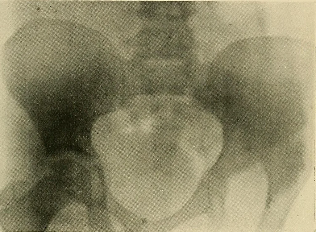 An illustration from The Röntgen rays in medical work, 1907, leaf 256