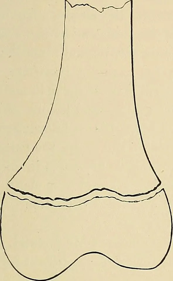 An illustration from The Röntgen rays in medical work, 1907, leaf 262